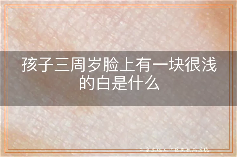 孩子三周岁脸上有一块很浅的白是什么