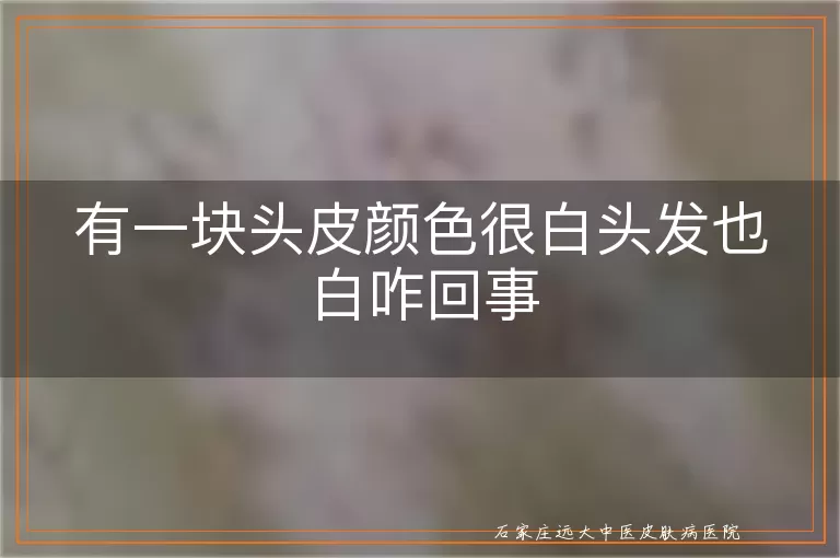 有一块头皮颜色很白头发也白咋回事