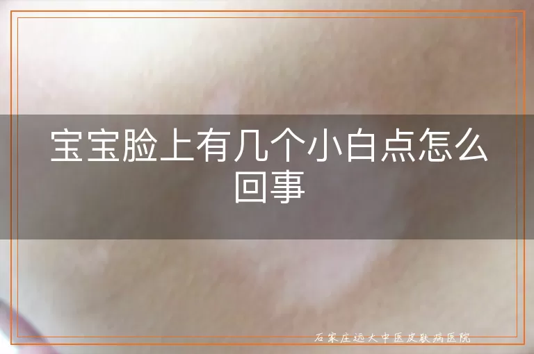 宝宝脸上有几个小白点怎么回事