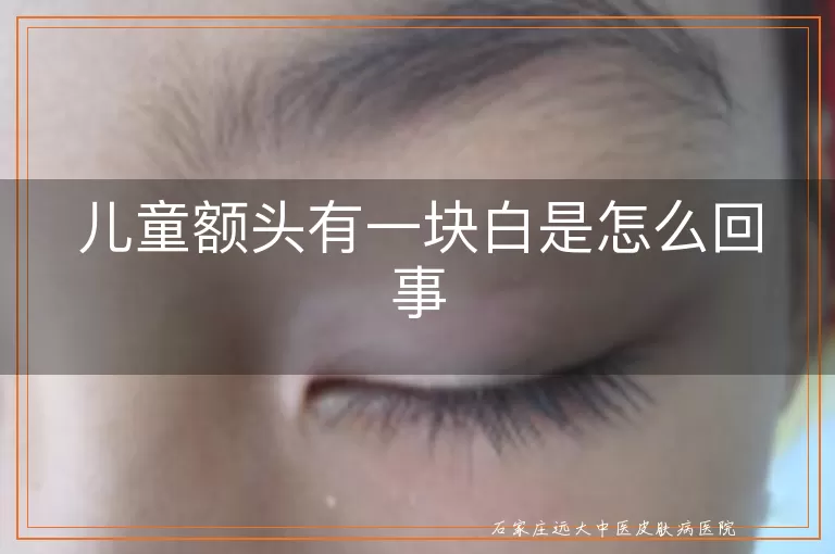 儿童额头有一块白是怎么回事