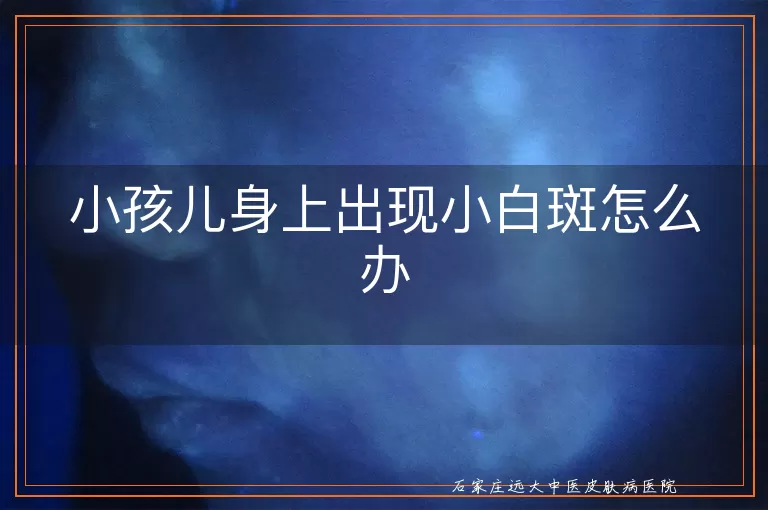 小孩儿身上出现小白斑怎么办