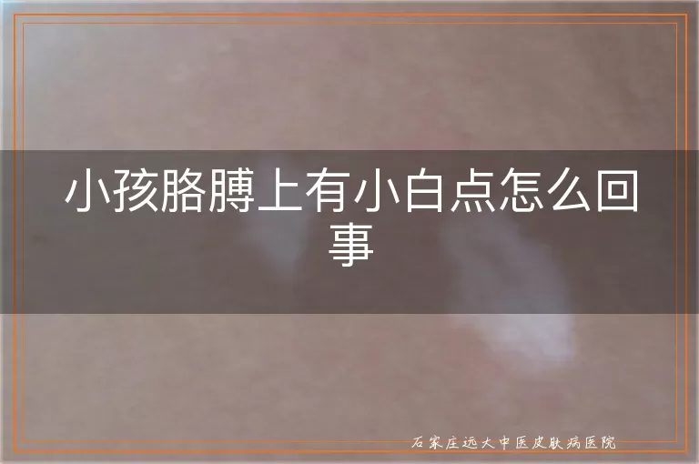 小孩胳膊上有小白点怎么回事