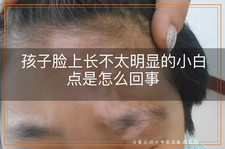 孩子脸上长不太明显的小白点是怎么回事