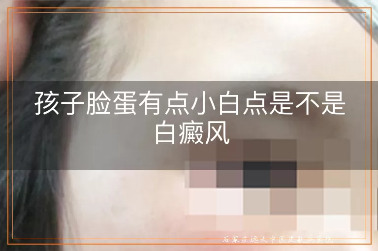 孩子脸蛋有点小白点是不是白癜风