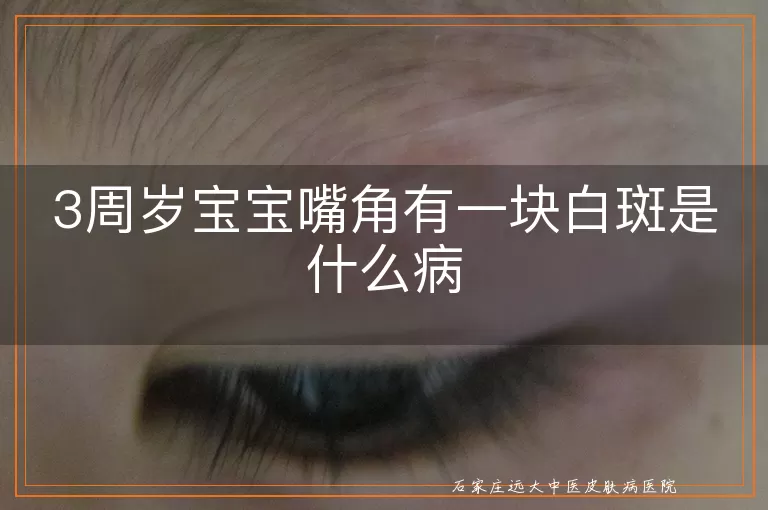 3周岁宝宝嘴角有一块白斑是什么病
