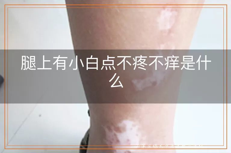 腿上有小白点不疼不痒是什么