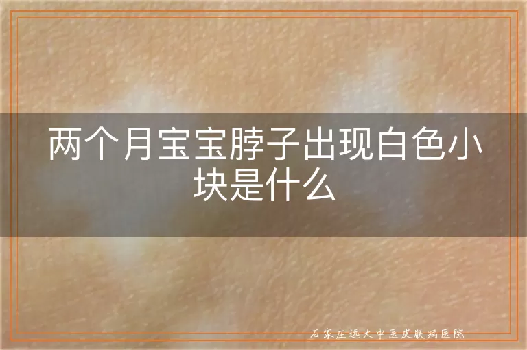 两个月宝宝脖子出现白色小块是什么