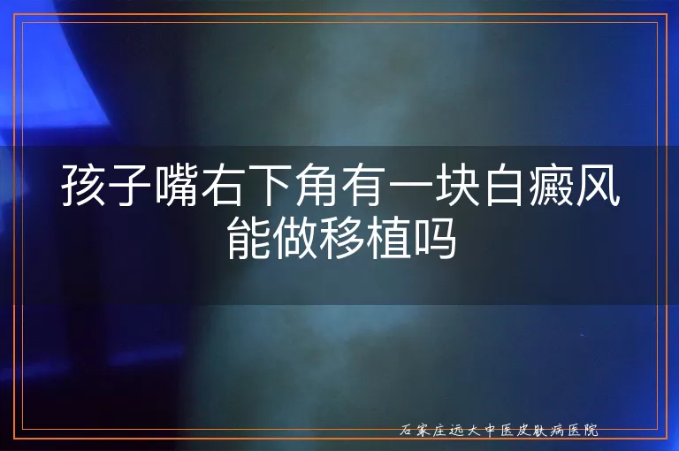 孩子嘴右下角有一块白癜风能做移植吗