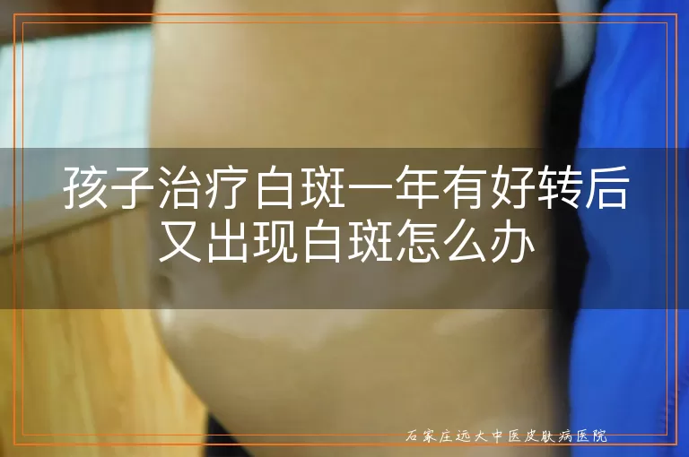 孩子治疗白斑一年有好转后又出现白斑怎么办