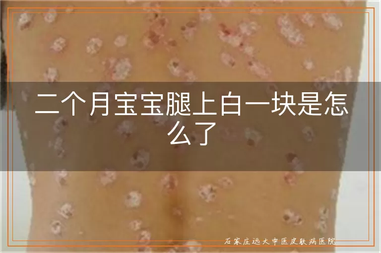 二个月宝宝腿上白一块是怎么了