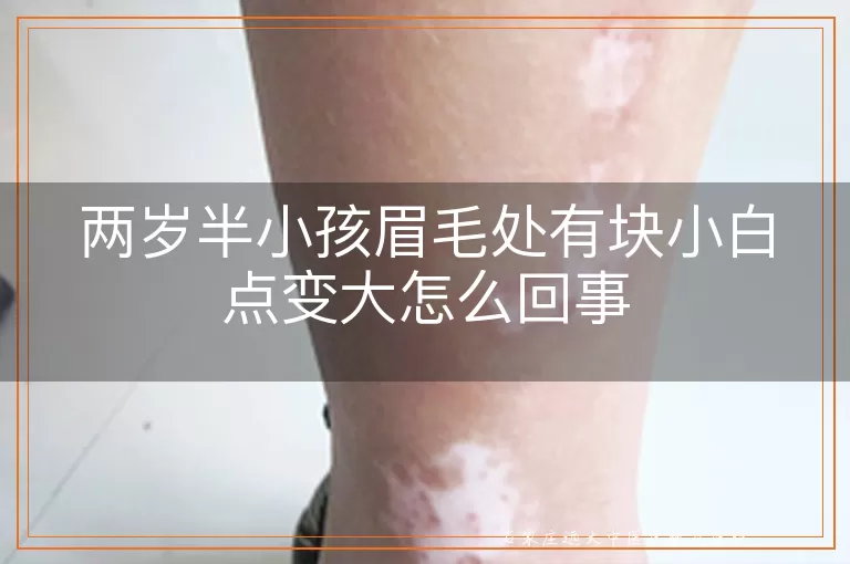 两岁半小孩眉毛处有块小白点变大怎么回事