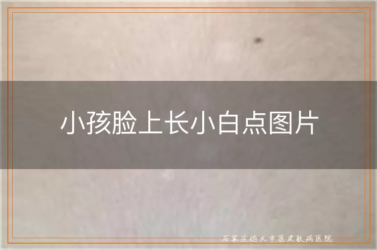 小孩脸上长小白点图片