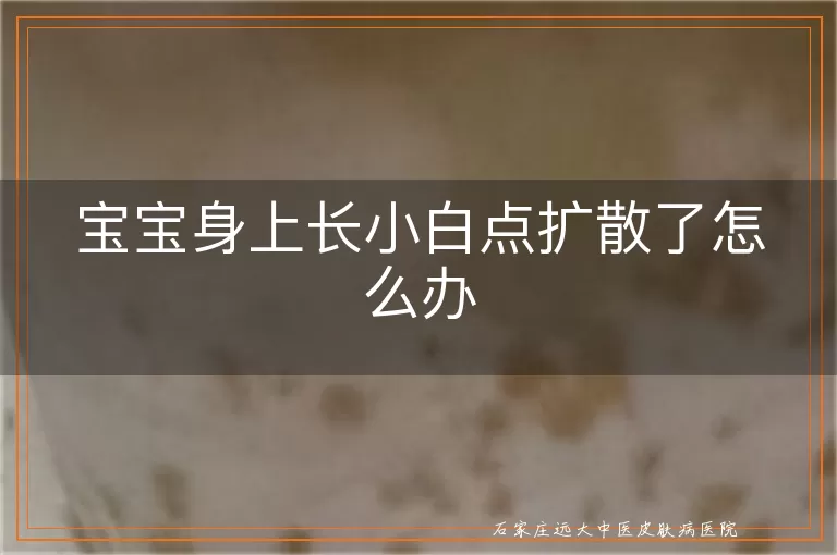 宝宝身上长小白点扩散了怎么办