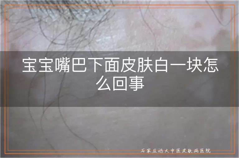 宝宝嘴巴下面皮肤白一块怎么回事