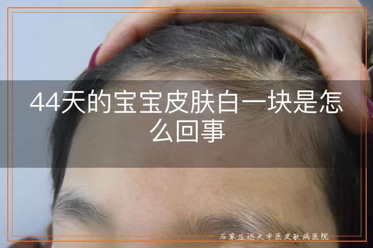 44天的宝宝皮肤白一块是怎么回事