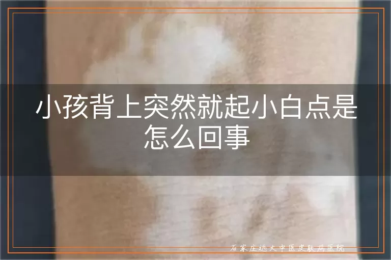 小孩背上突然就起小白点是怎么回事