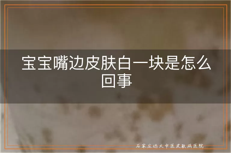 宝宝嘴边皮肤白一块是怎么回事