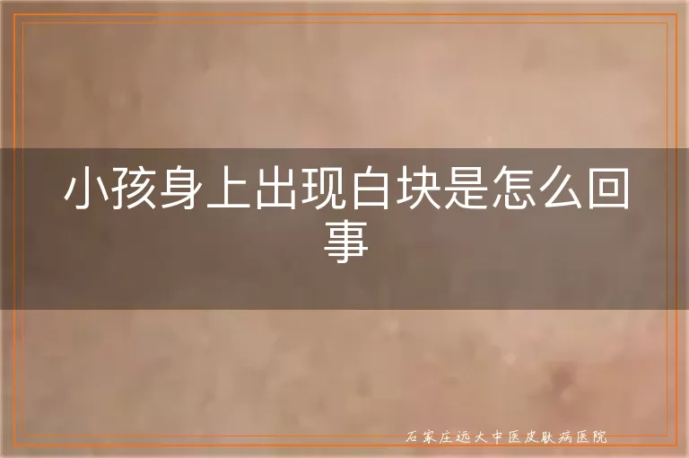 小孩身上出现白块是怎么回事