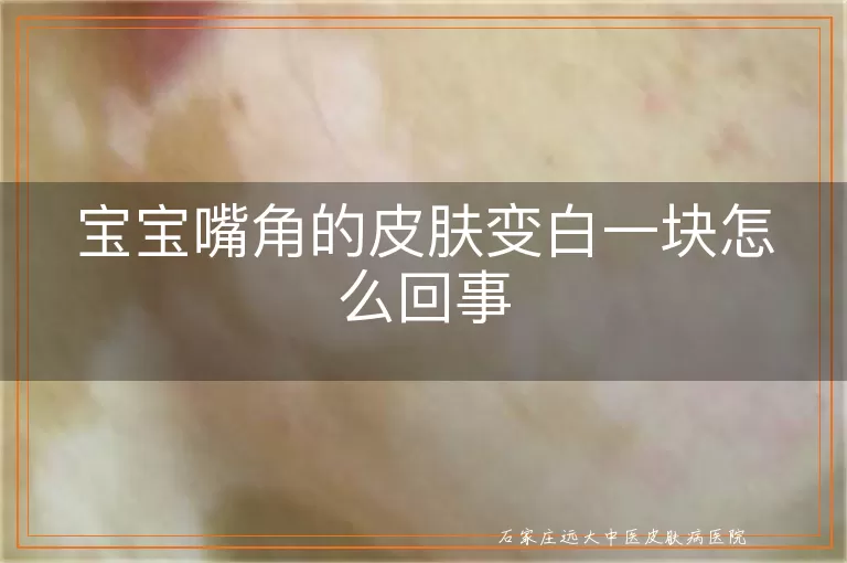 宝宝嘴角的皮肤变白一块怎么回事