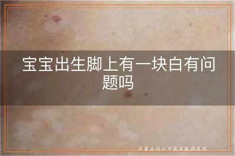 宝宝出生脚上有一块白有问题吗
