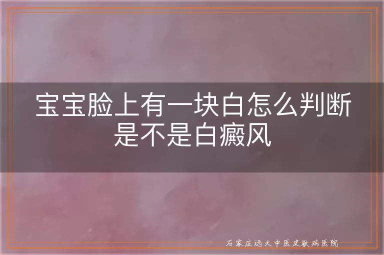 宝宝脸上有一块白怎么判断是不是白癜风