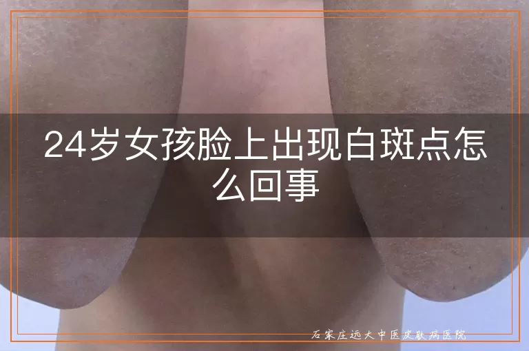 24岁女孩脸上出现白斑点怎么回事
