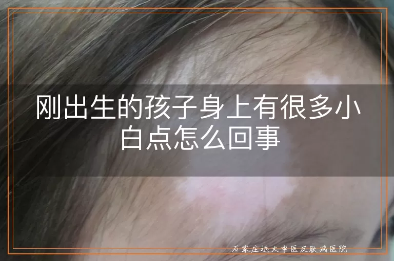 刚出生的孩子身上有很多小白点怎么回事