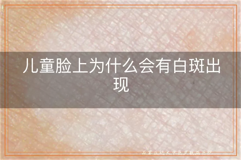 儿童脸上为什么会有白斑出现