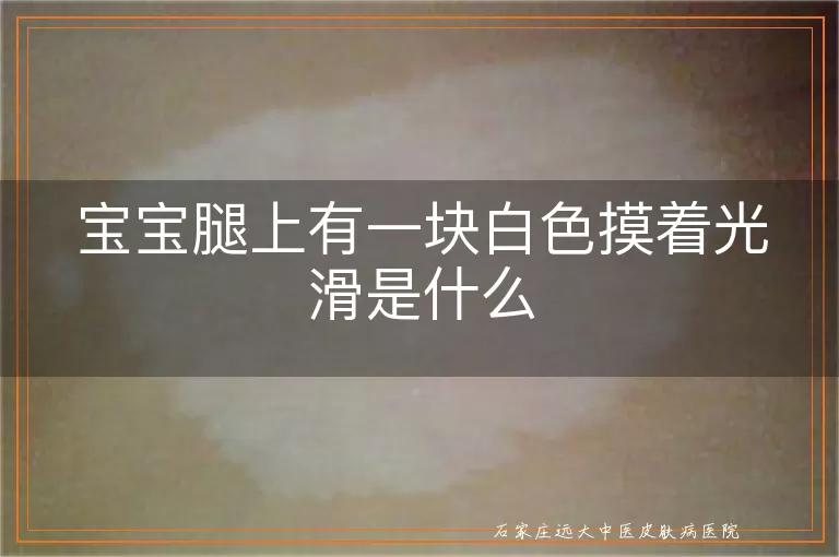 宝宝腿上有一块白色摸着光滑是什么