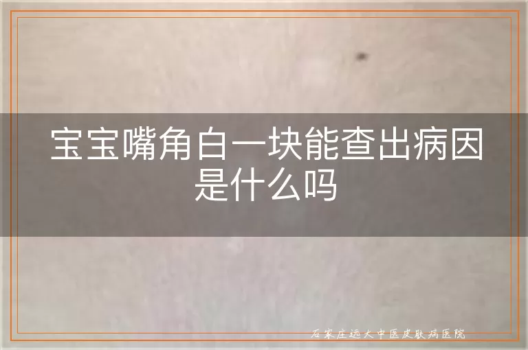 宝宝嘴角白一块能查出病因是什么吗