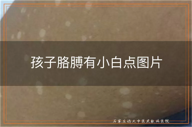 孩子胳膊有小白点图片