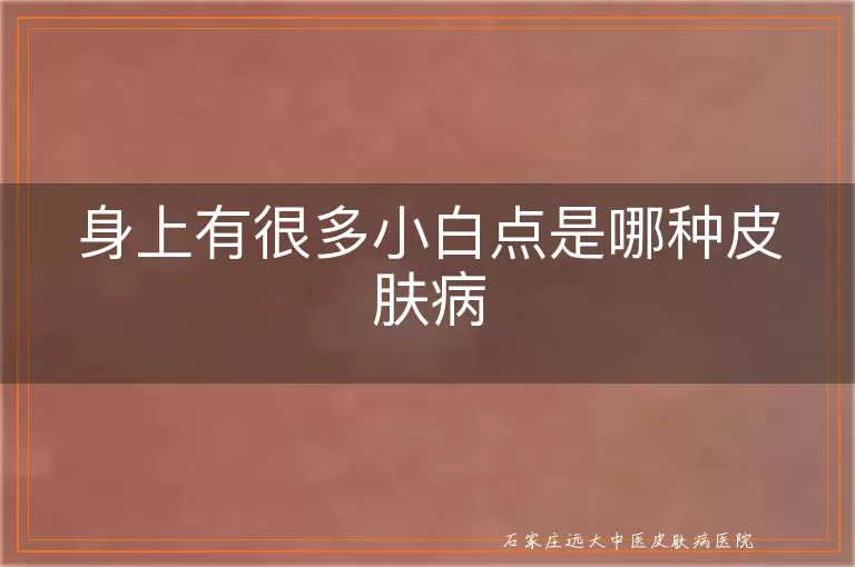 身上有很多小白点是哪种皮肤病