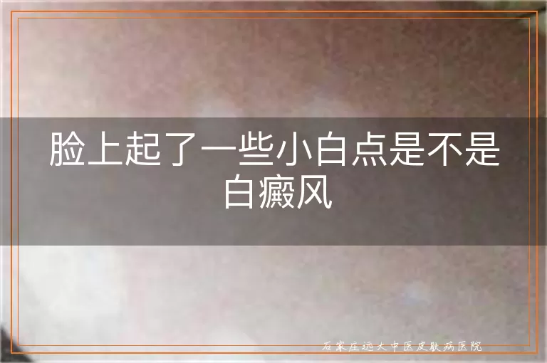 脸上起了一些小白点是不是白癜风