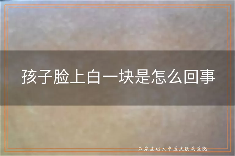 孩子脸上白一块是怎么回事