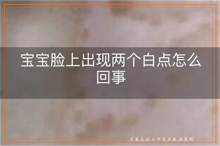 宝宝脸上出现两个白点怎么回事