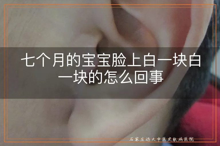 七个月的宝宝脸上白一块白一块的怎么回事