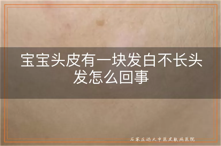 宝宝头皮有一块发白不长头发怎么回事