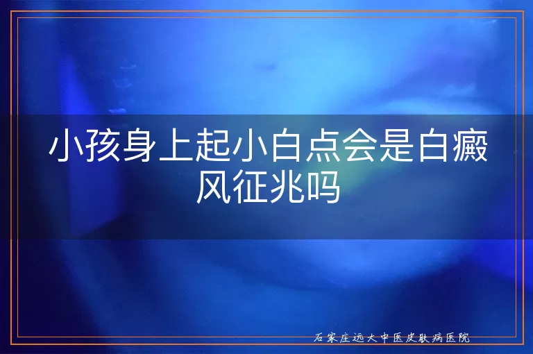 小孩身上起小白点会是白癜风征兆吗