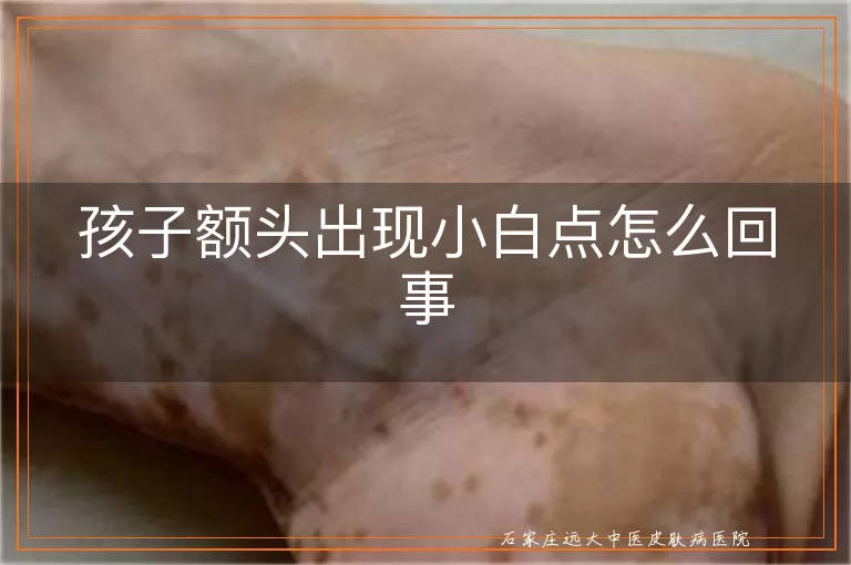 孩子额头出现小白点怎么回事