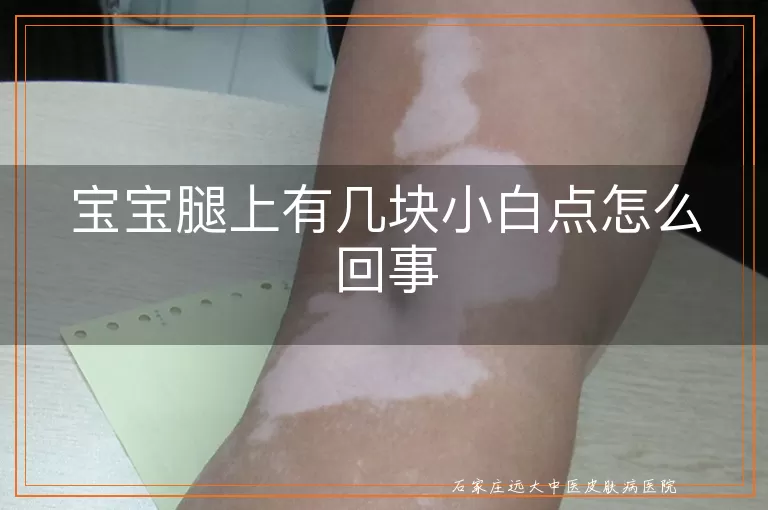 宝宝腿上有几块小白点怎么回事