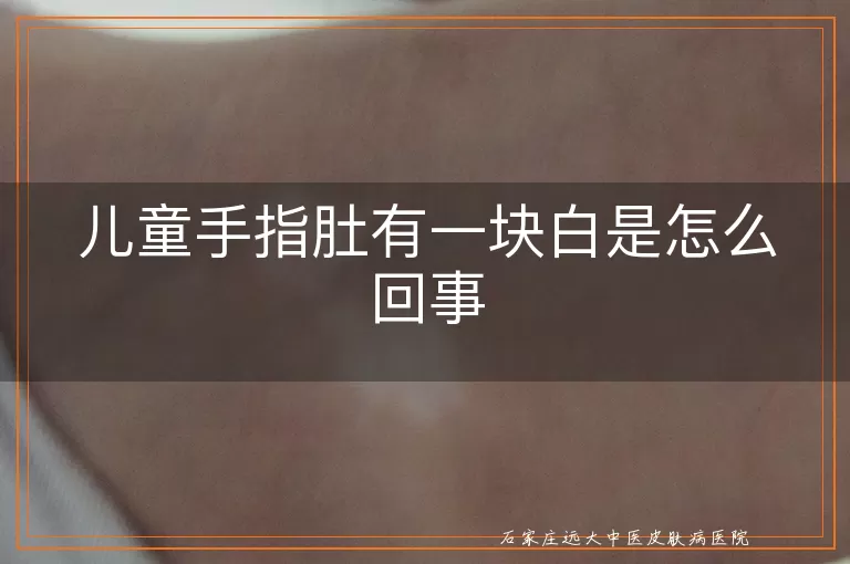 儿童手指肚有一块白是怎么回事