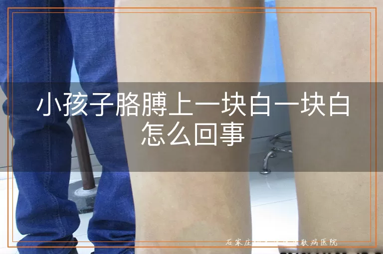 小孩子胳膊上一块白一块白怎么回事