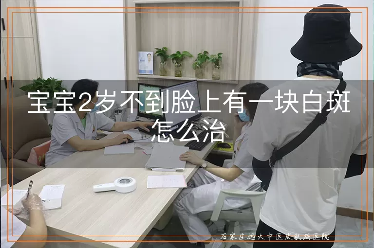 宝宝2岁不到脸上有一块白斑怎么治