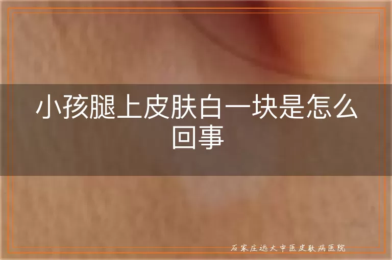 小孩腿上皮肤白一块是怎么回事