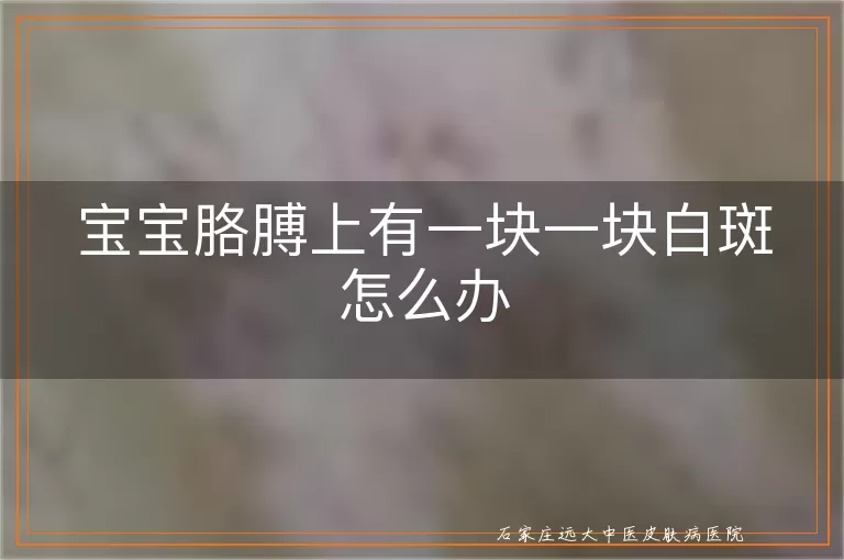 宝宝胳膊上有一块一块白斑怎么办