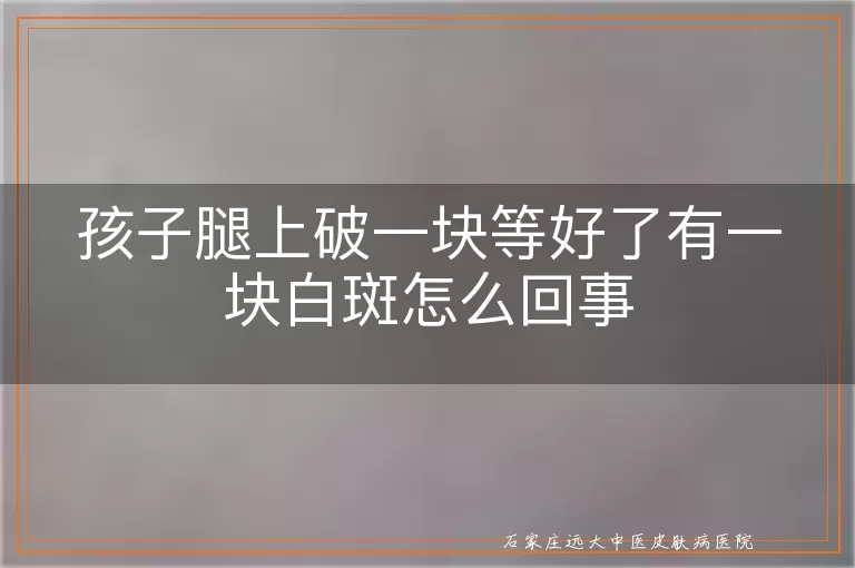 孩子腿上破一块等好了有一块白斑怎么回事