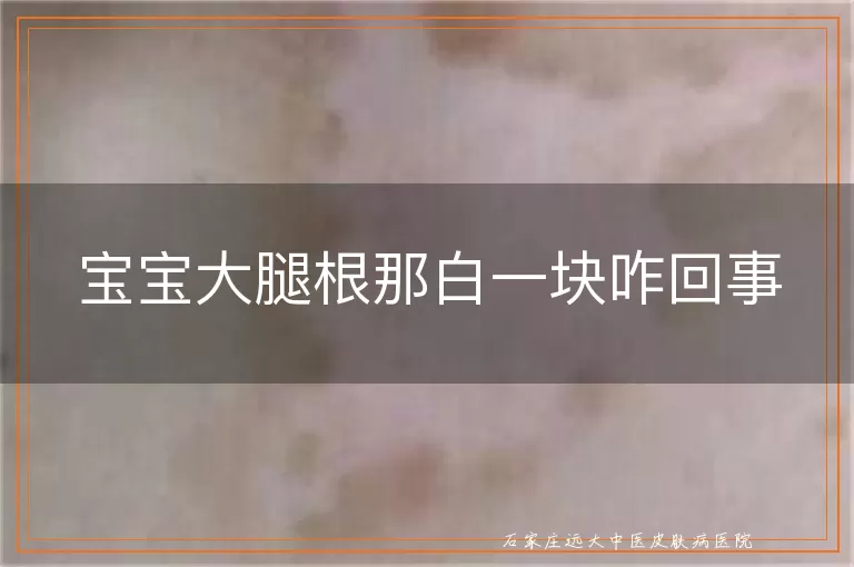 宝宝大腿根那白一块咋回事