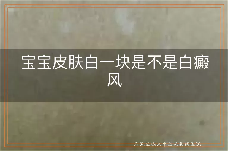 宝宝皮肤白一块是不是白癜风