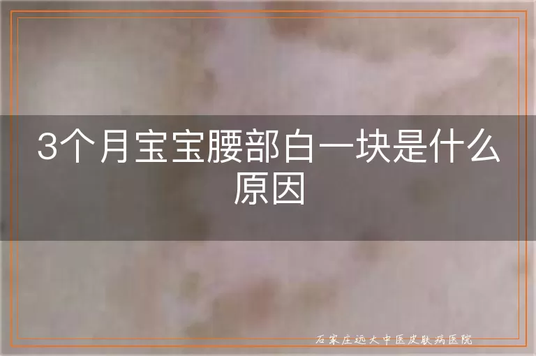 3个月宝宝腰部白一块是什么原因