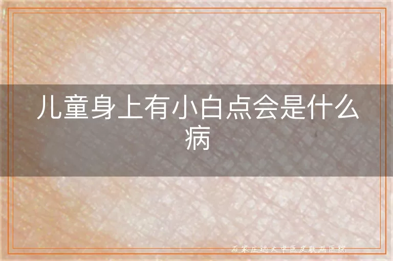 儿童身上有小白点会是什么病